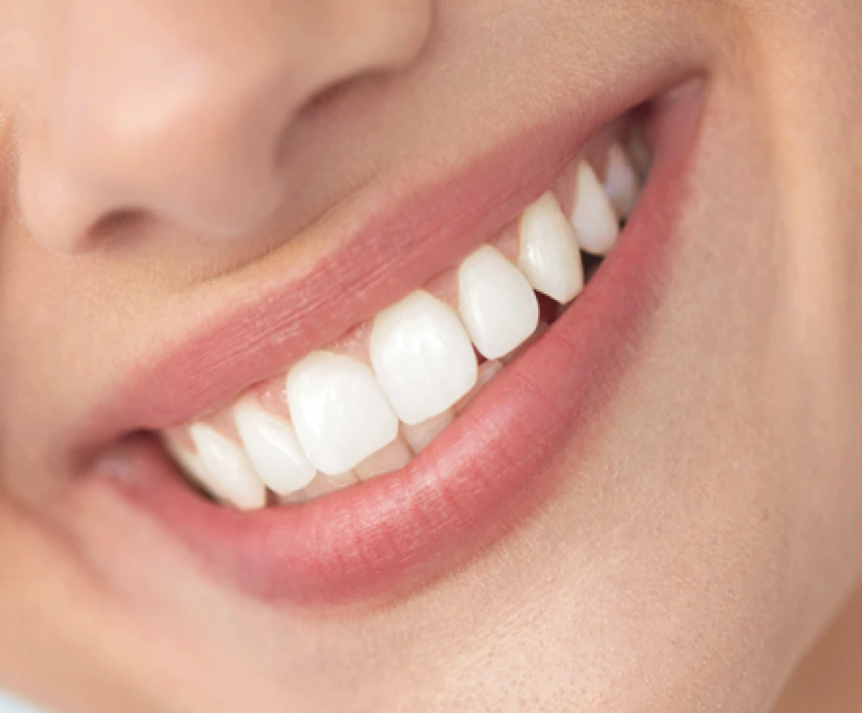 L’éclaircissement dentaire 1 belles dents