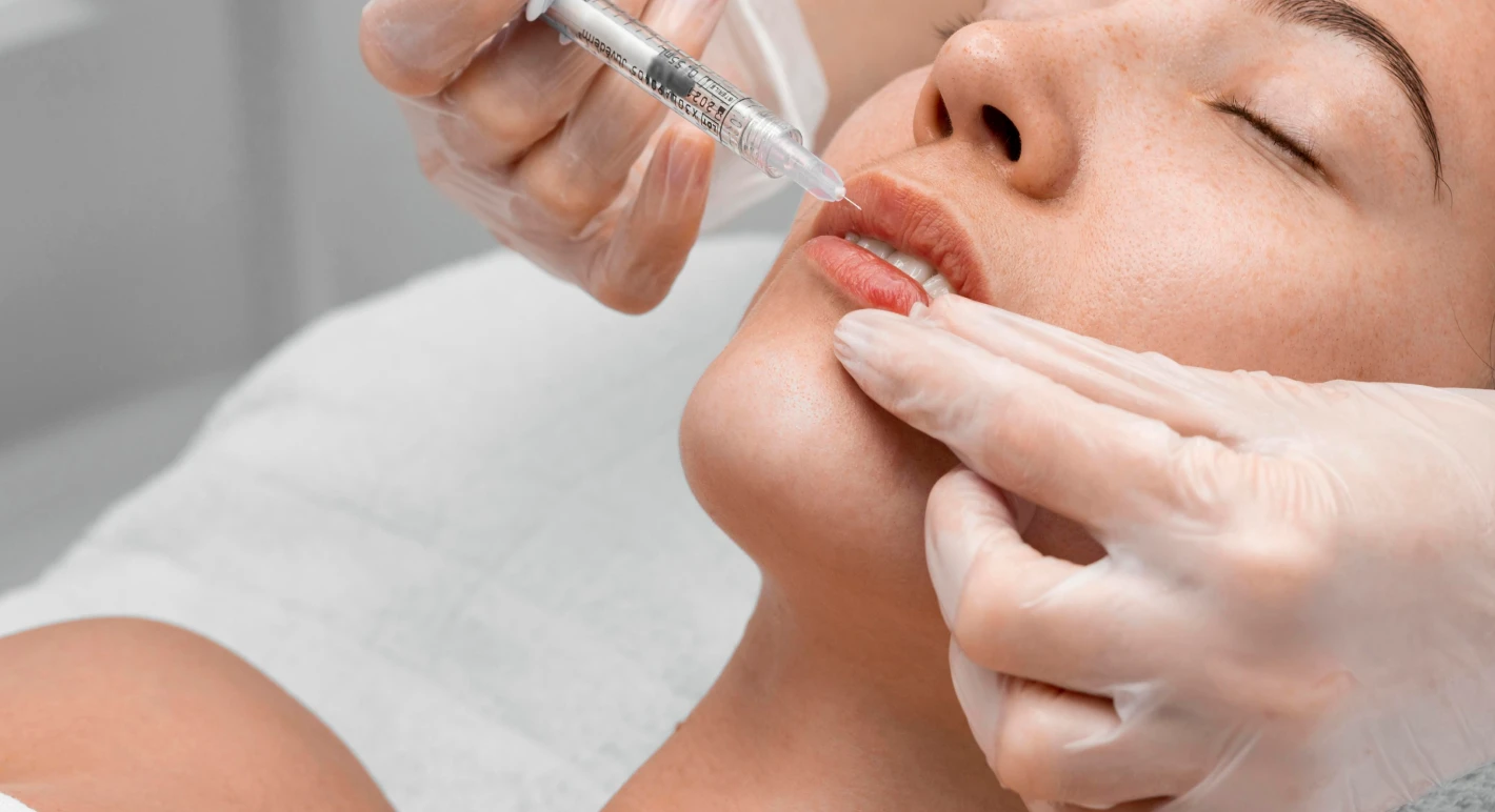 Injection d'acide hyaluronique 1 Procédure d'injection d'acide hyaluronique dans les lèvres